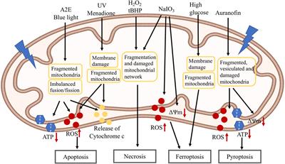 Role of Mitochondria in Retinal Pigment Epithelial Aging and Degeneration